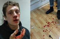 В Днепре неизвестные в балаклавах избили двух местных активистов (обновлено)