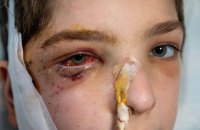 З початку війни Росія вбила в Україні 103 дитини