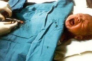 Власти Берлина сняли запрет на обрезание