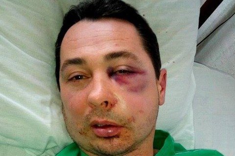 В Каховке избили лидера списка БПП