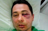 В Каховке избили лидера списка БПП