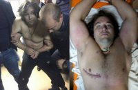 Підозрюваний у вбивстві патрульних невдовзі одужає