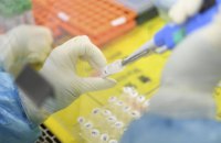 У Тернопільській області зафіксували вже 133 випадки COVID-19