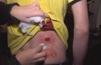 Журналисты устроили в Раде акцию в поддержку избитых коллег