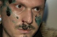"Террорист" Осмаев намеревался заниматься в Одессе бизнесом