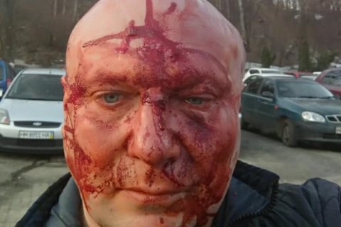Известного киевского догхантера Святогора жестоко избили после суда