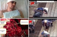 Викладачеві ХАІ, якого побили сепаратисти, потрібна допомога