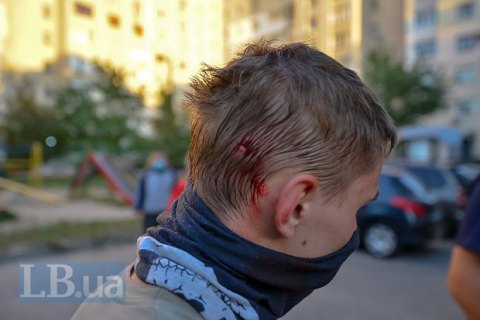 Трое человек обратились к врачам после ночных столкновений на Святошино