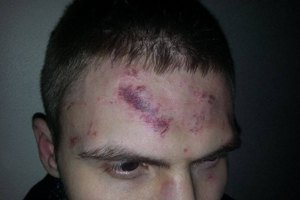 В Киеве совершено еще одно нападение на общественного активиста