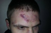 В Киеве совершено еще одно нападение на общественного активиста