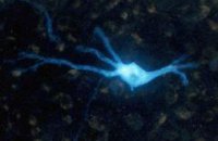 Любовь вместо анальгина