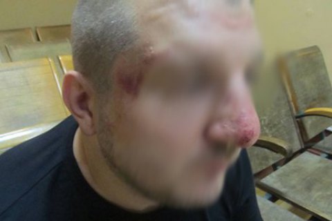 Российские пограничники высадили с поезда и избили украинца, направлявшегося в РФ
