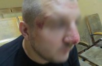Российские пограничники высадили с поезда и избили украинца, направлявшегося в РФ