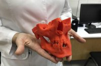 В Национальном медуниверситете открыли стоматологическую лабораторию с 3D-принтерами