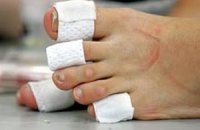 Липосакция пальцев ног бьет рекорды по популярности