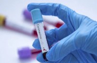 ​За минулу добу ковід підтвердили у 7959 українців