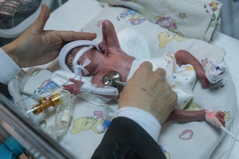 Внаслідок стрілянини в турецькому Ізмірі 12 людей поранено, серед них - 6 дітей