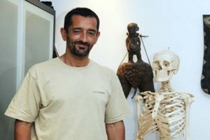 В Испании провели первую в мире пересадку ног