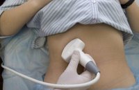 Власти штата Айова ужесточили правила проведения абортов