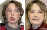 Во Франции умерла первая в мире женщина, которой пересадили лицо