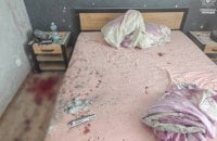 На Рівненщині в руках хлопця вибухнула граната, яку його батько привіз із зони бойових дій