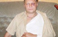 Избитого фанами сотрудника "Динамо" решили уволить