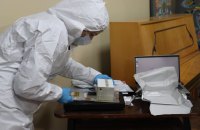У Міноборони пропонують додати відбитки рук і ніг до ДНК-ідентифікації військових