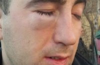 Участник АТО обвиняет замглавы РГА в нападении